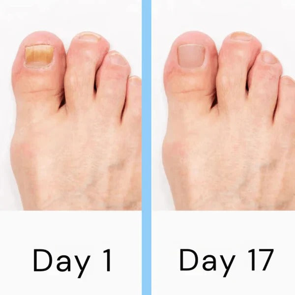 The Mani-Pure Pro: Professional Electric Nail File with Multi-Header Logic