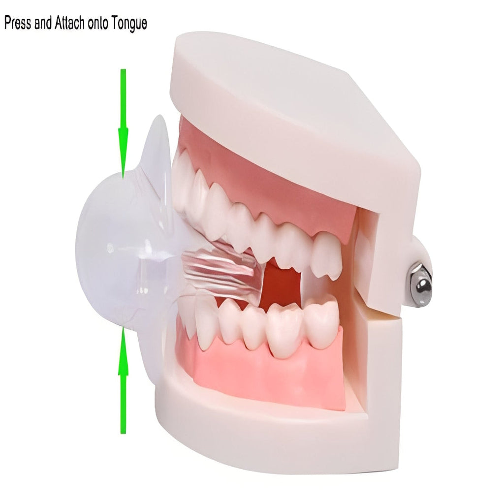 The Air-Flow Sentry: Tongue Positioning Device for Open-Airway Sleeping